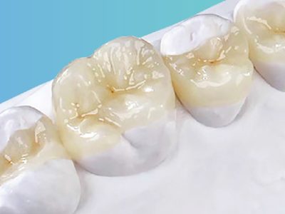 Restaurativa indiretta