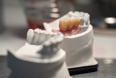 Protesi Dentaria Fissa
