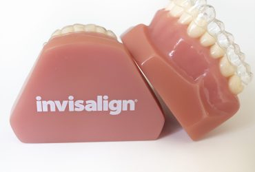 Invisalign